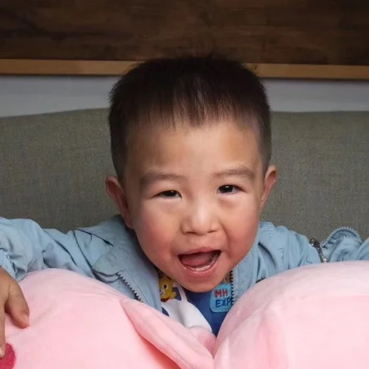 ZHAO YL Medical Condition: Cleft Lip & Palate