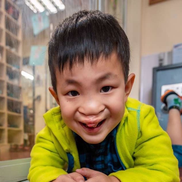 WU ZK Medical Condition: Cleft Lip & Palate