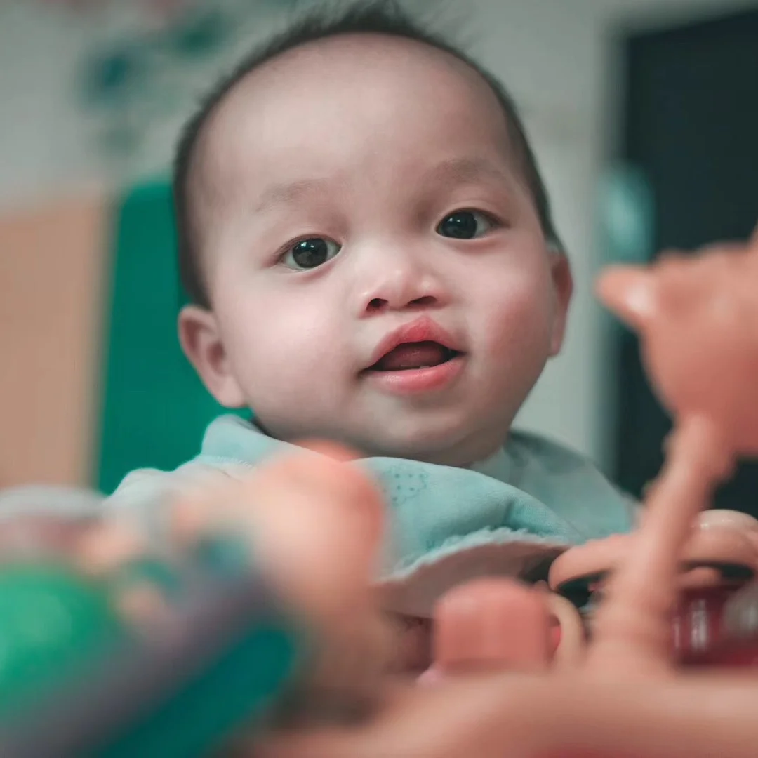 GAO FJ Medical condition: cleft lip and palate