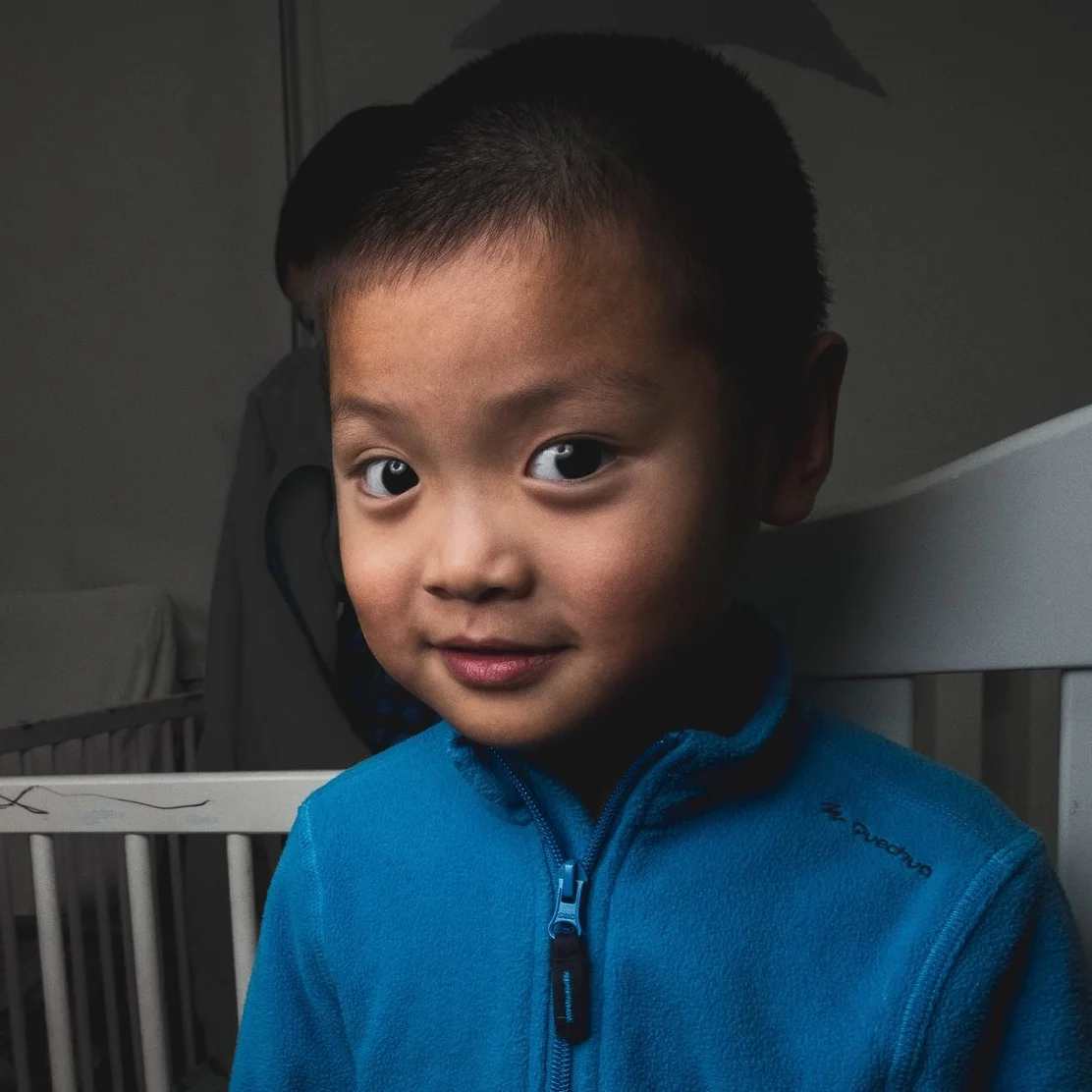 ZHAO YB Medical Condition: Cataract & Autism