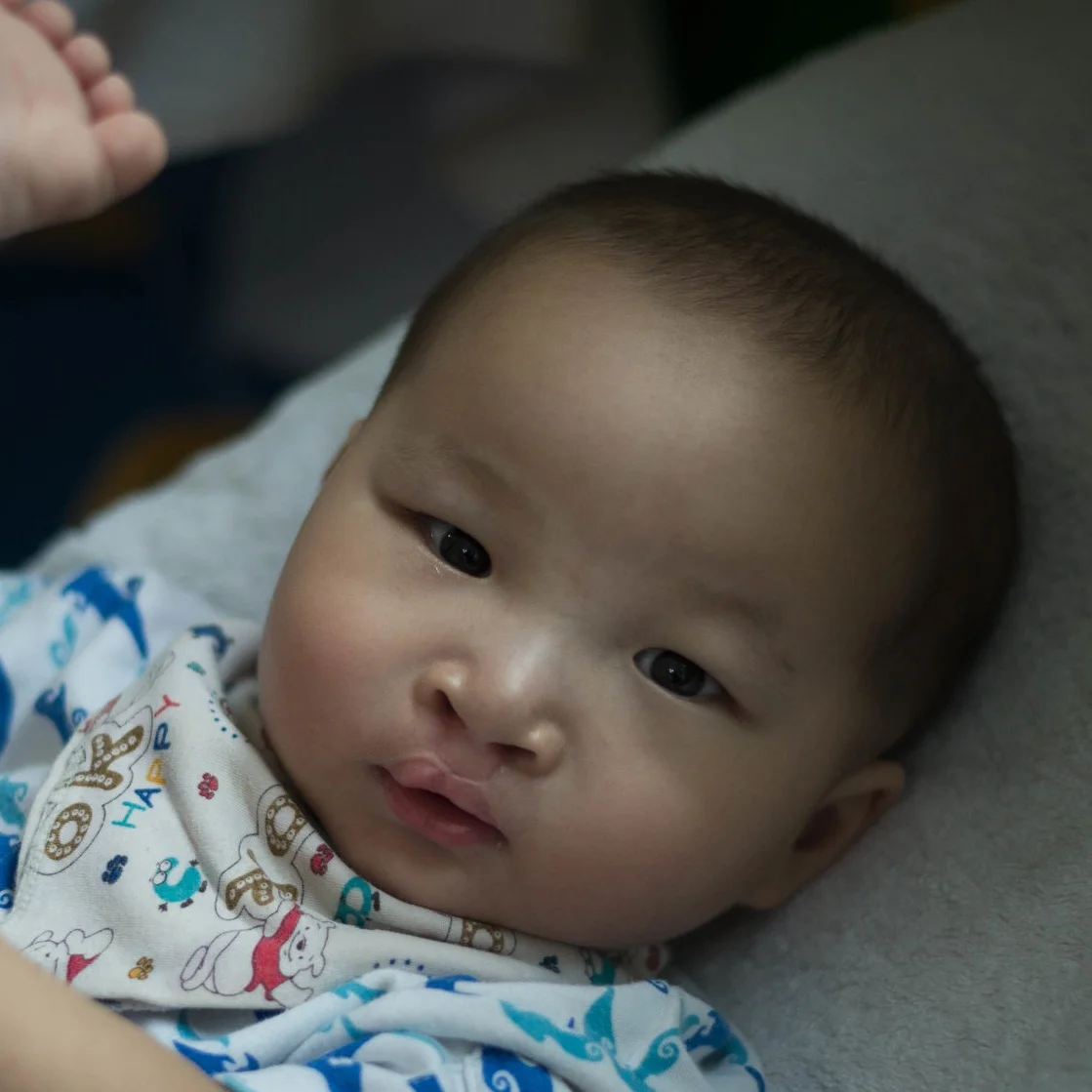 SHANGH XJ Medical Condition: Cleft lip & palate