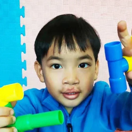 LUO SY Medical Condition: Hearing impairment and cleft lip and palate