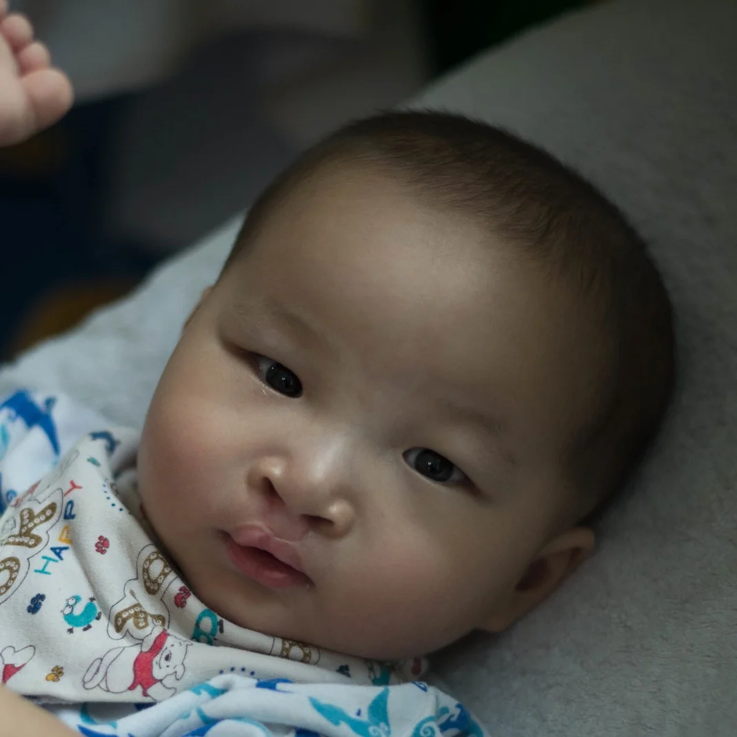 SHANG XJ Medical Condition: Cleft lip and palate