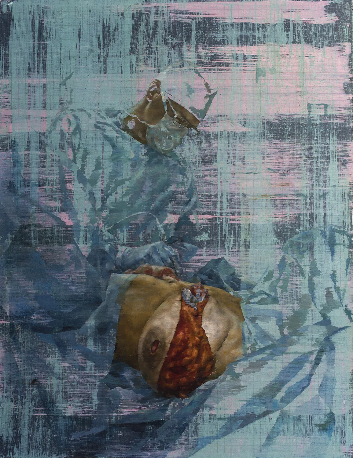 Mastectomy with Double Incision BOOK FINAL.jpg