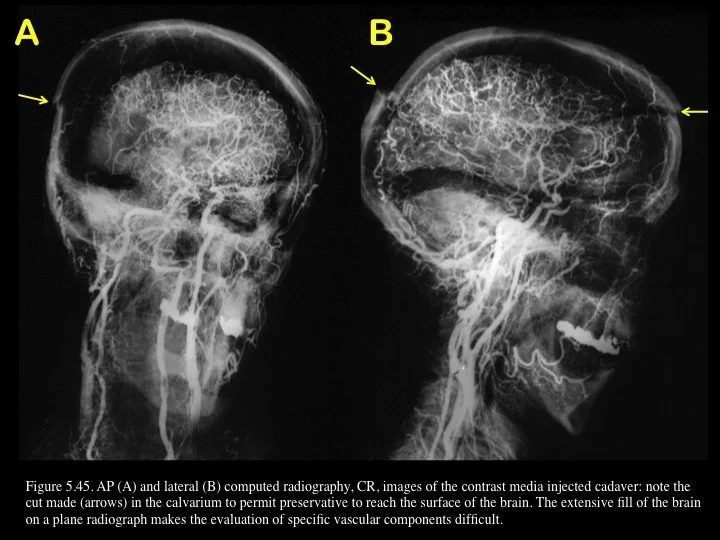 Figure 5.45.jpg
