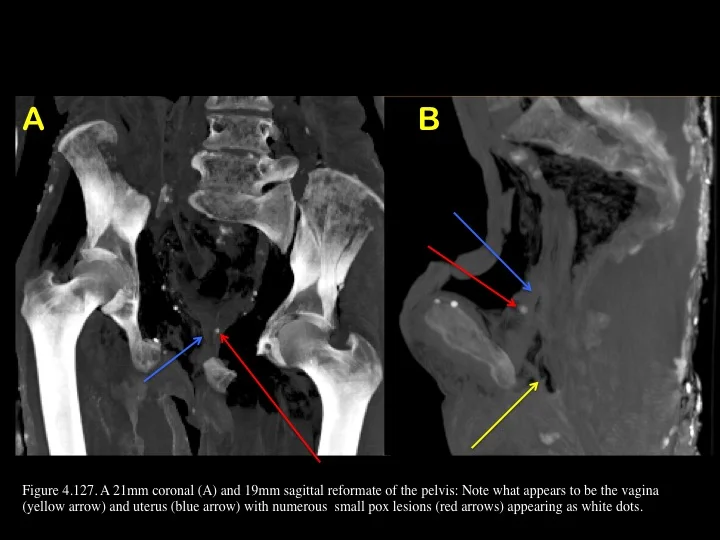 Figure 4.127.jpg