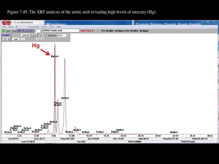 Figure 7.49.jpg
