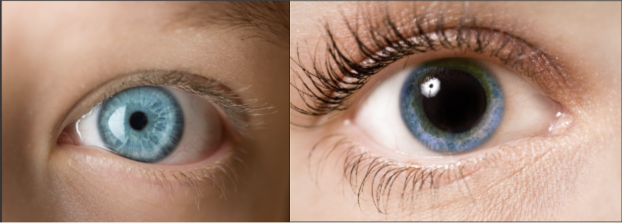 Eye Conditions.png
