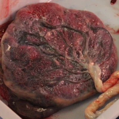 placenta.jpg