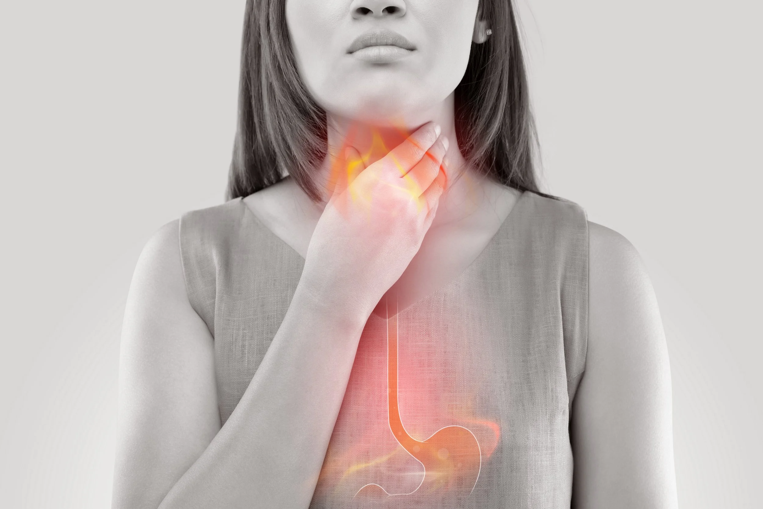5 Strategies to Alleviate Acid Reflux