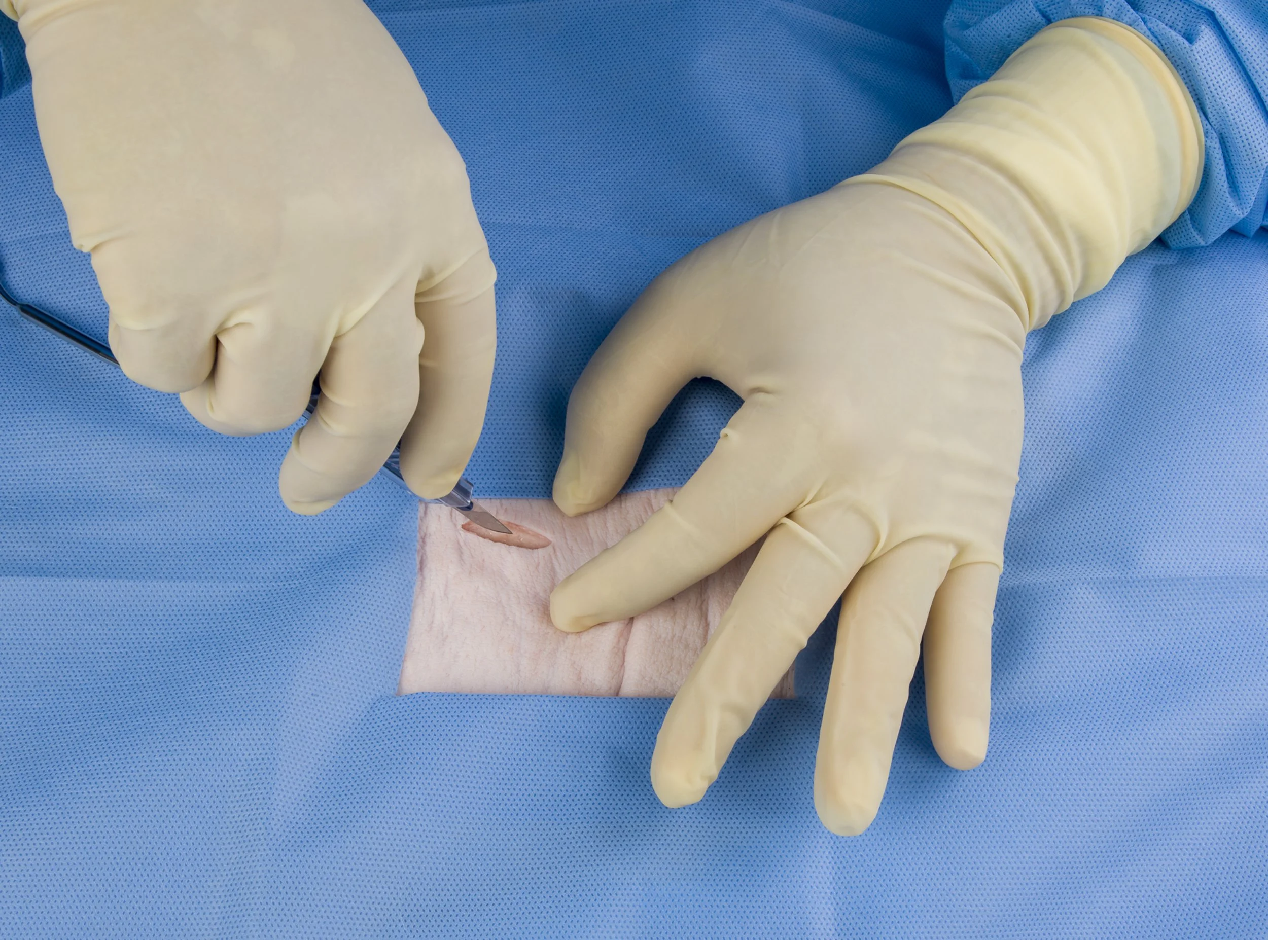 Ethicon Prolene Photo OSP