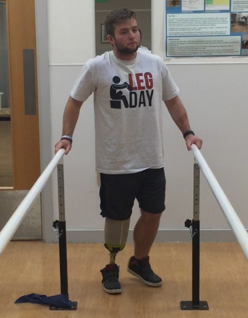 How Does it Feel to Walk on a Prosthetic Leg?