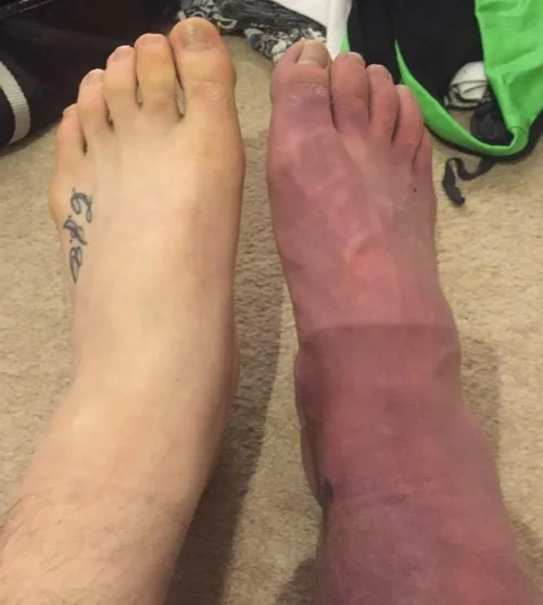 Foot 1.jpg