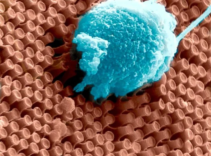 Primary cortical neurons cultured on the surface of an array of optoelectronic nanowires. Here a neuron is pulling the nanowires, indicating the the cell is doing well on this material. 