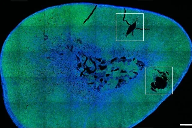 Researchers achieve remote control of hormone release using magnetic nanoparticles