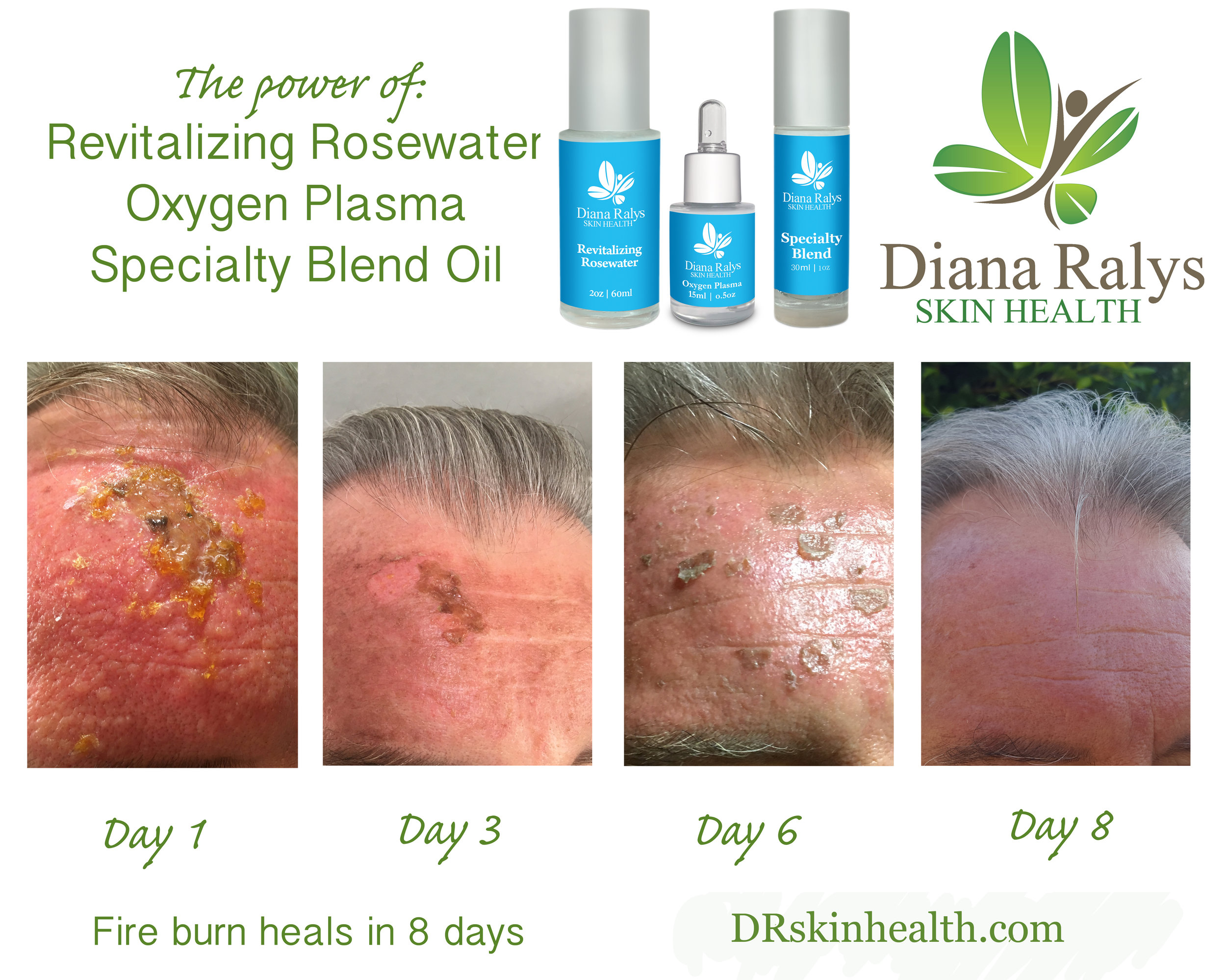 oxygen plasma serum