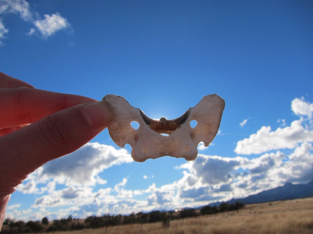 Butterfly vertebrae