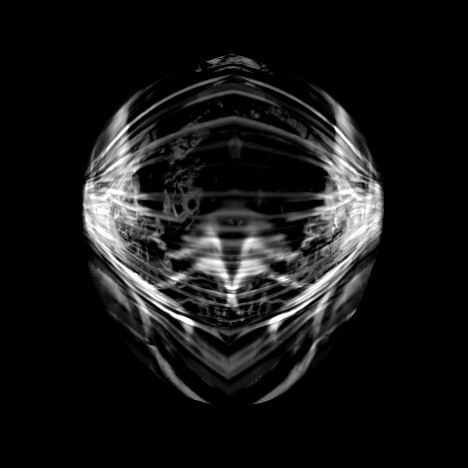 MRI