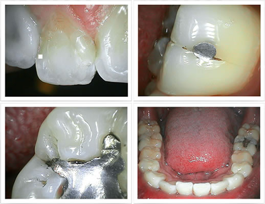 High resolution images show the smallest details on the surface of the teeth