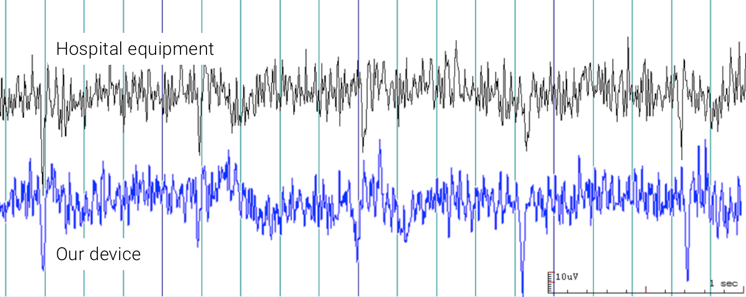 Neural activity output of our device compared to the hospital equipment