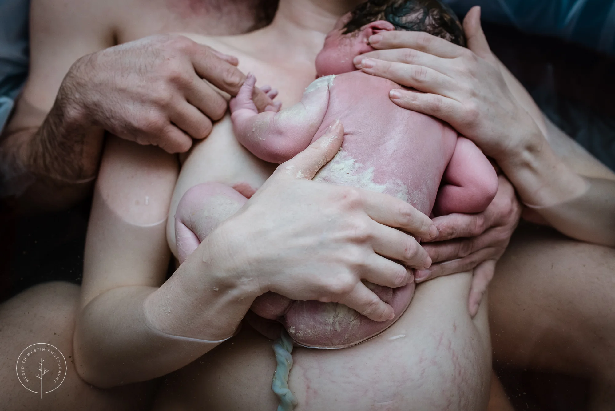 Twin Cities Birth Photography-17.jpg