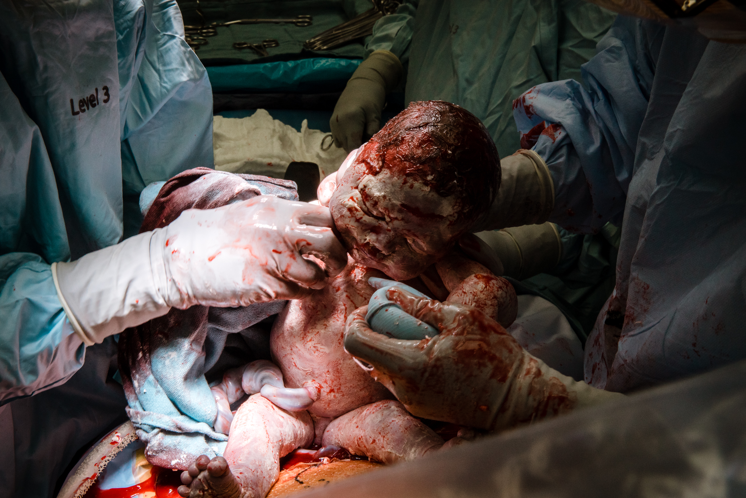 Meredith Westin Photography- Minneapolis Birth Stories and Films c section riverside premier-7.jpg