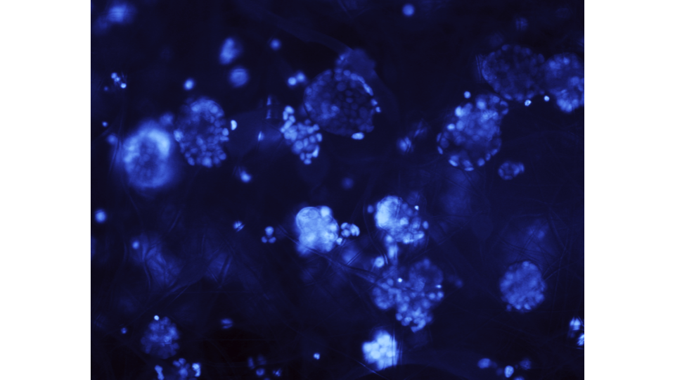 Gen-1 Tumoroids (1 unit)