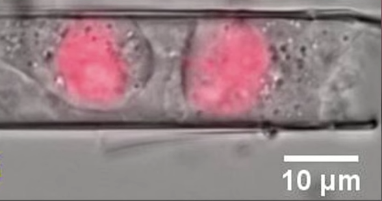 How cancer cells may divide and spread