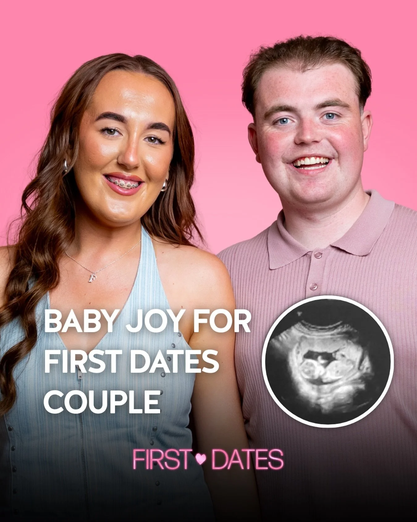 Big congratulations to James &amp; Fayth 💕🥺

The couple, who will be appearing in this weeks episode, revealed on the @latelaterte they&rsquo;re expecting! 👶
 
Wishing them all the best 🫶💕

#FirstDatesIRL | Thursday 9:30pm @rte2 &amp; @rteplayer
