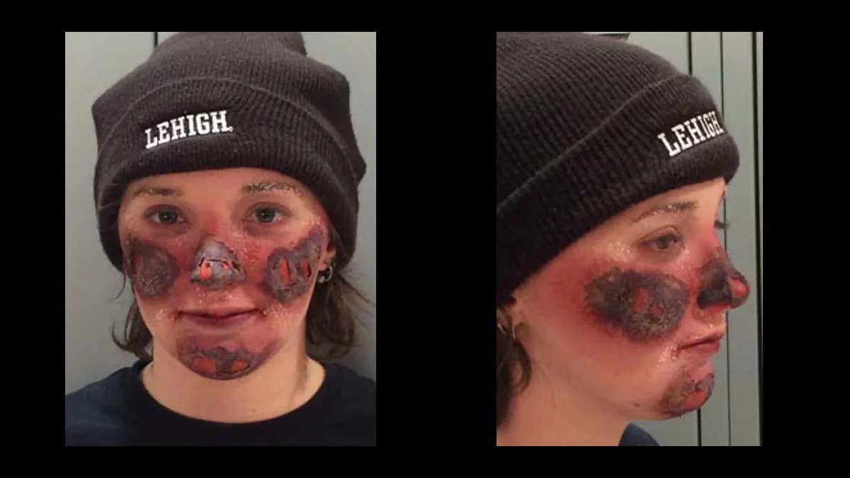 injury_makeup_2015.jpg