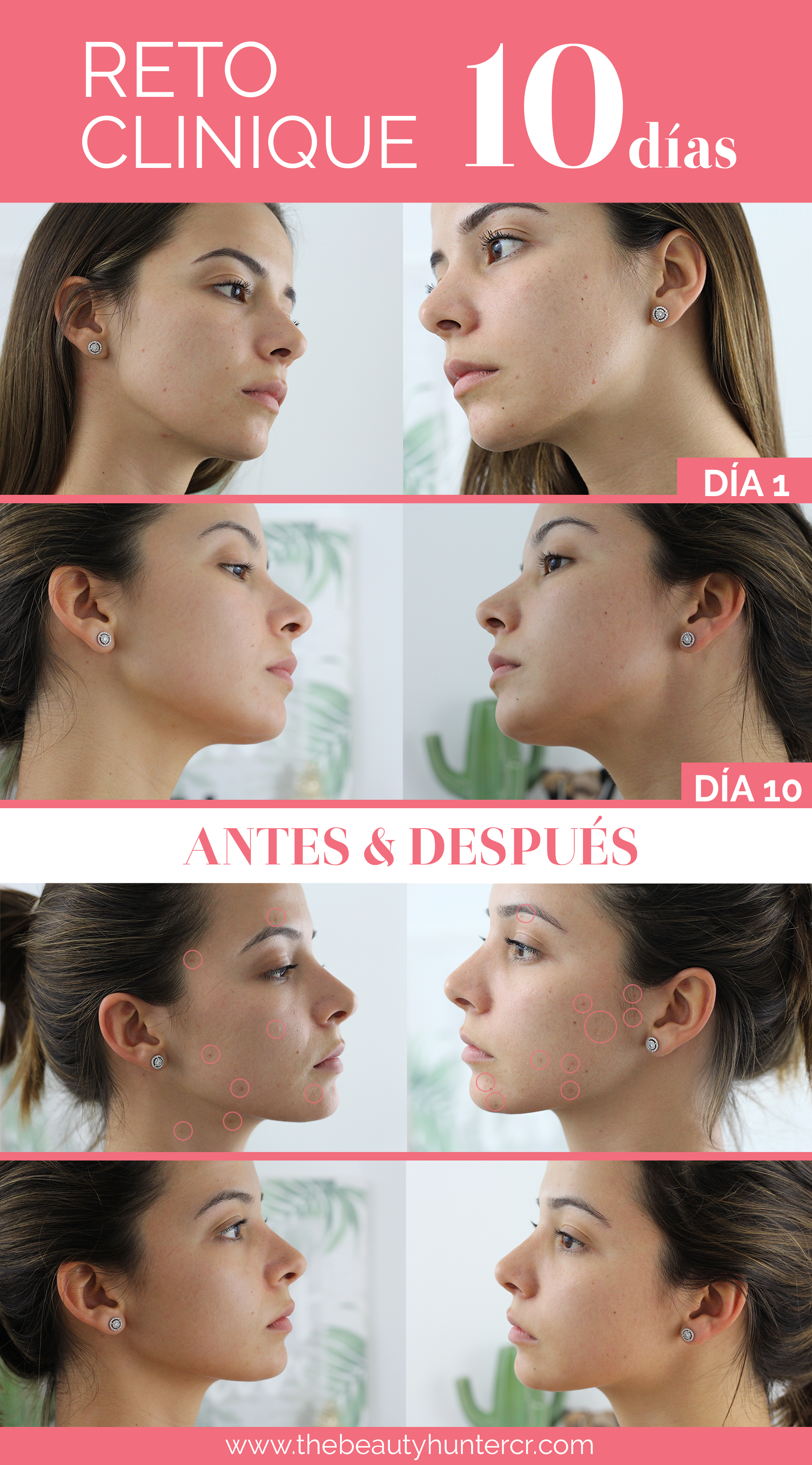 Presets by Valeria Homberger — RETO 10 Días de Clinique: mi piel antes y  después
