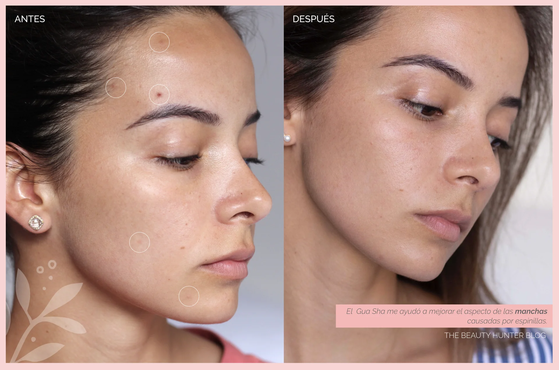 resultados-gua-sha2.jpeg