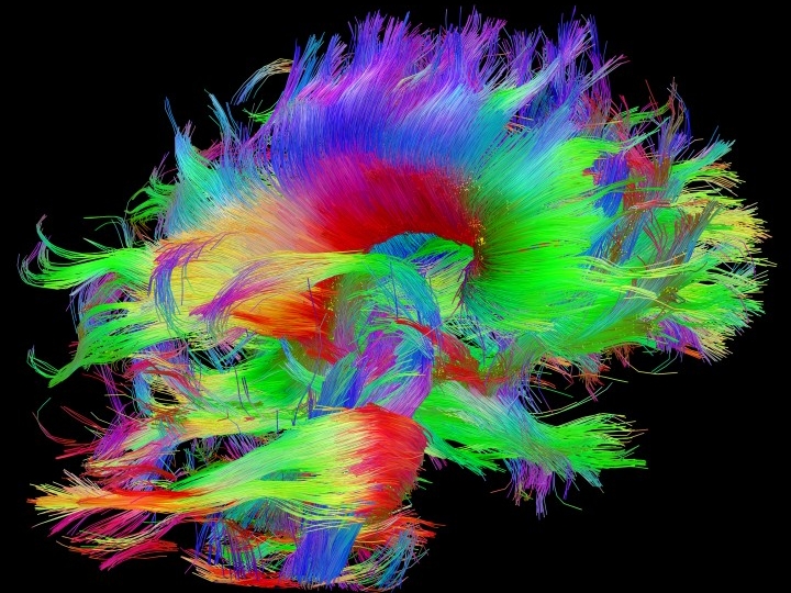 White matter fiber architecture of the brain. Measured from diffusion spectral imaging (DSI). The fibers are color-coded by direction: red = left-right, green = anterior-posterior, blue = up-down. www.humanconnectomeproject.org