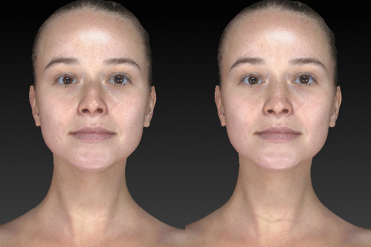 Vectra 3D imaging - preview potential results before they happen.