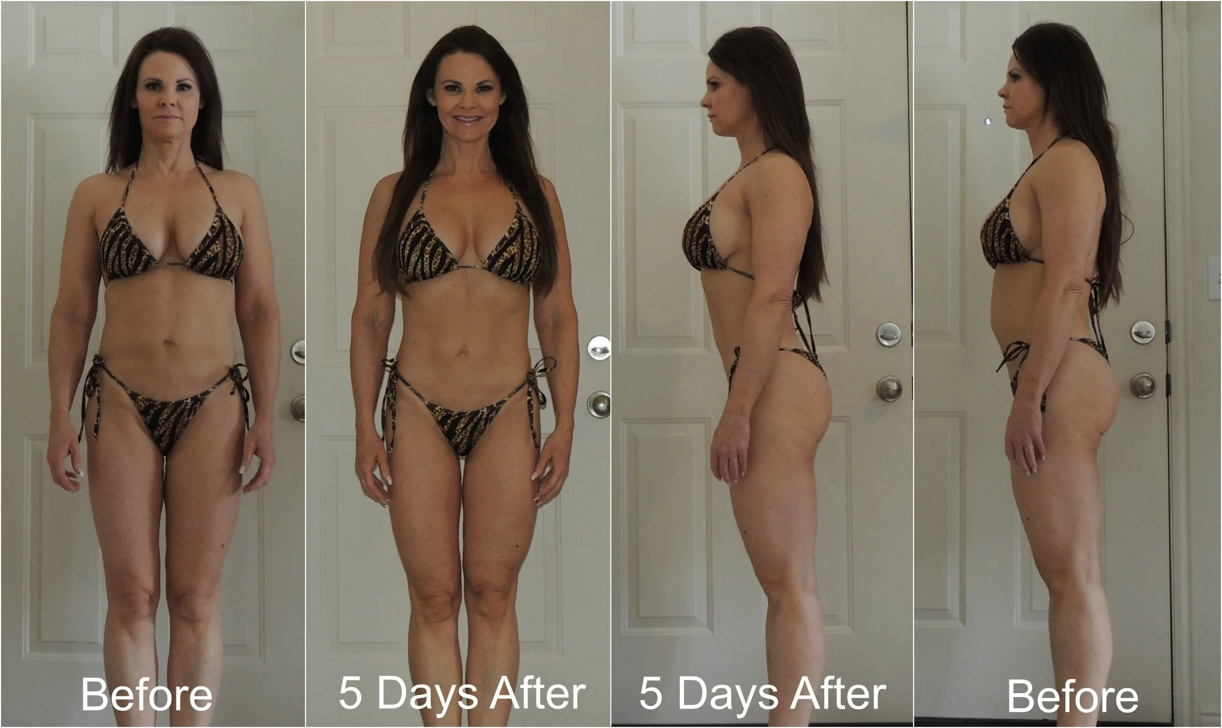 My ProLon Fasting Mimicking Diet Experience