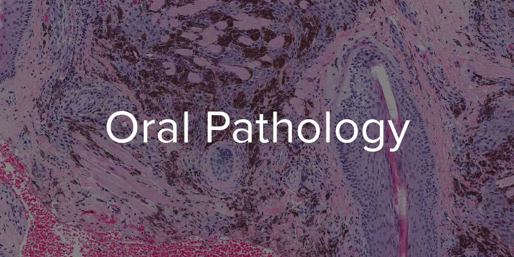 Oral Pathology