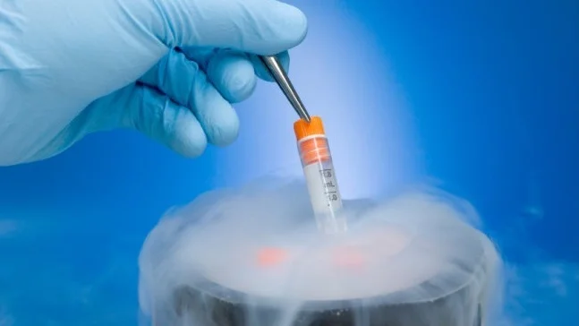 egg freezing procedure pic 2