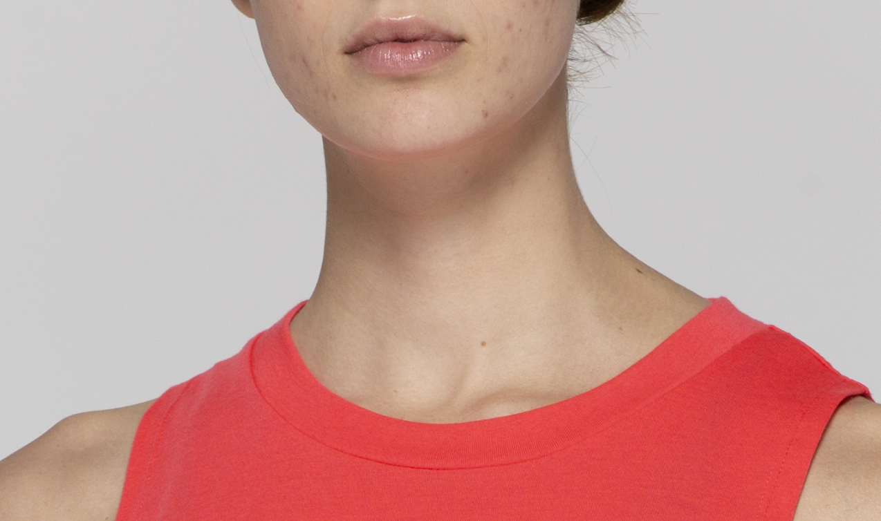 skin01.png
