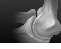 Arthrex Elbow Products