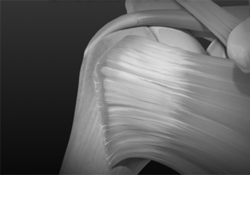 Arthrex Shoulder Products