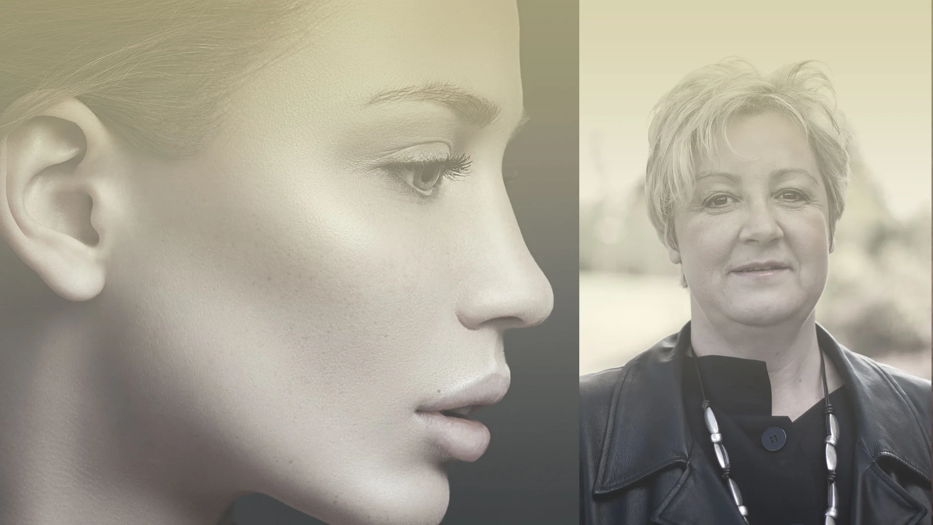 Facelift