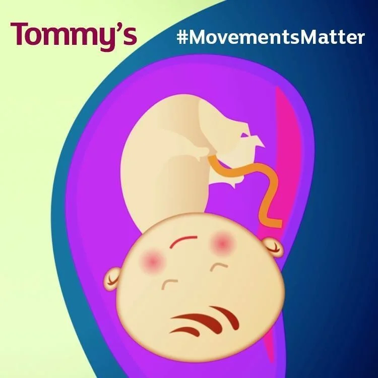 Foetal #MovementsMatter | Monitoring in Pregnancy