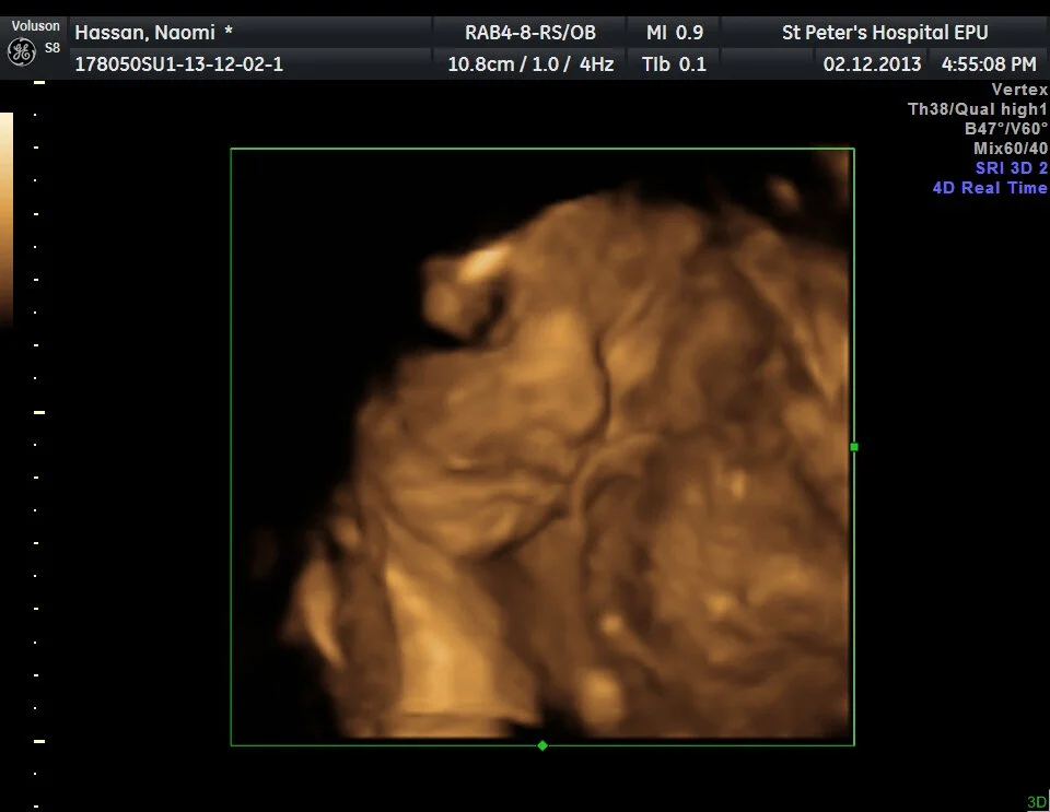 4D Bonding Scans | Pregnancy Memories | Me Becoming Mum