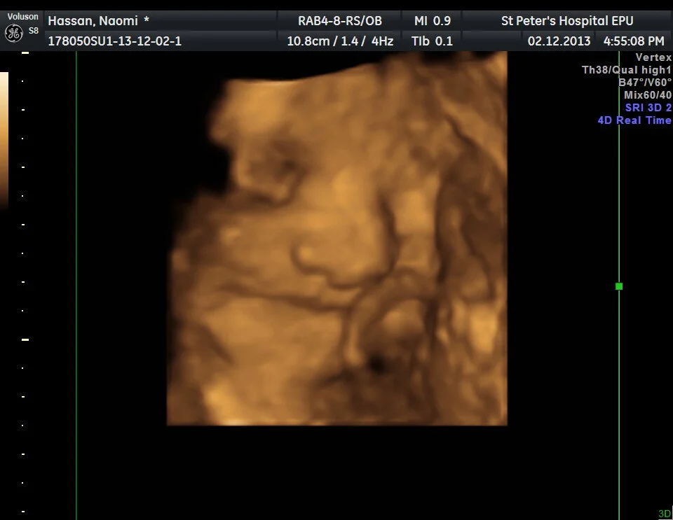 4D Bonding Scans | Pregnancy Memories | Me Becoming Mum