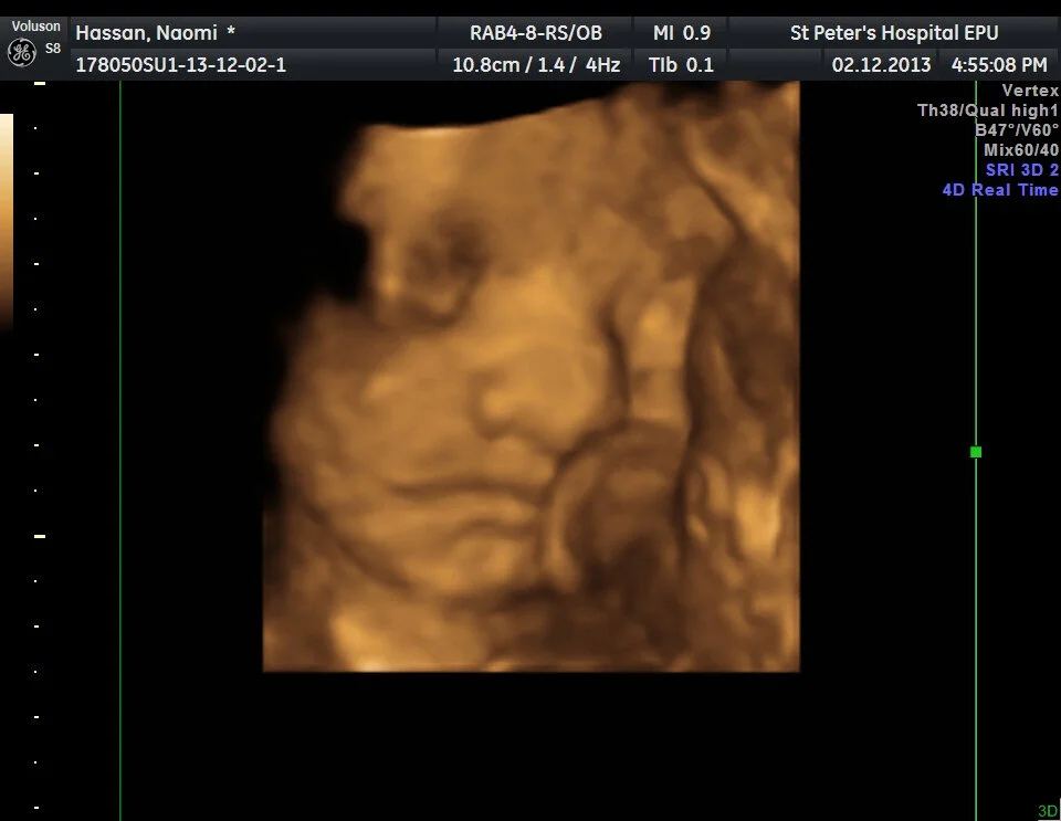 4D Bonding Scans | Pregnancy Memories | Me Becoming Mum