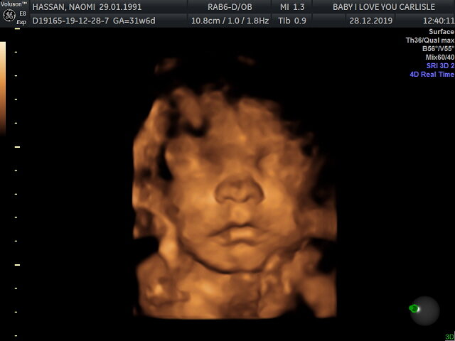 Munchkin's 4D Bonding Scan | Baby I Love You, Carlisle | Me Becoming Mum