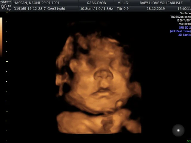 Munchkin's 4D Bonding Scan | Baby I Love You, Carlisle | Me Becoming Mum