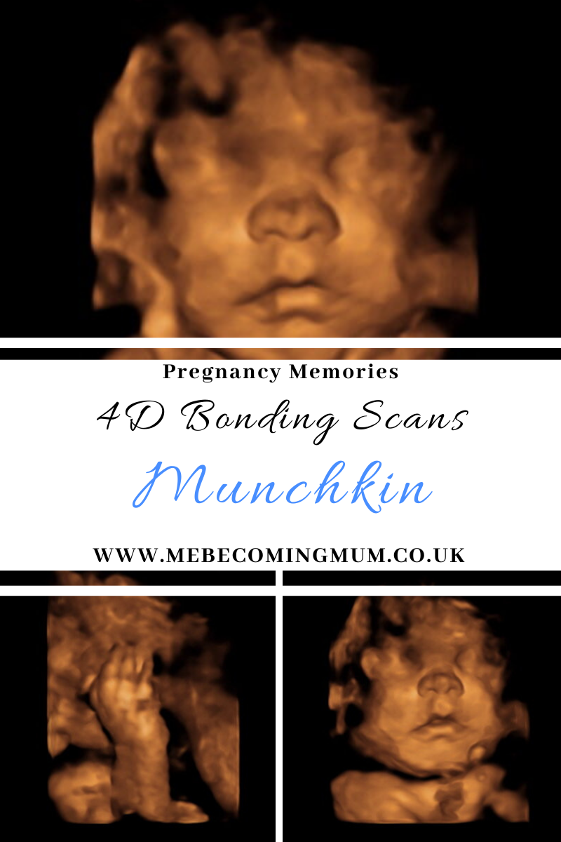 Munchkin's 4D Bonding Scan | Baby I Love You, Carlisle | Me Becoming Mum