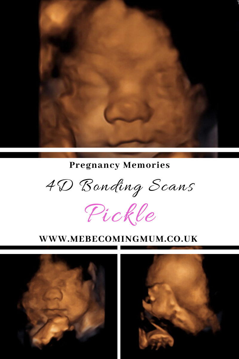 Pickle's 4D Bonding Scan | Ultrasound Direct, Peterborough | Me ...