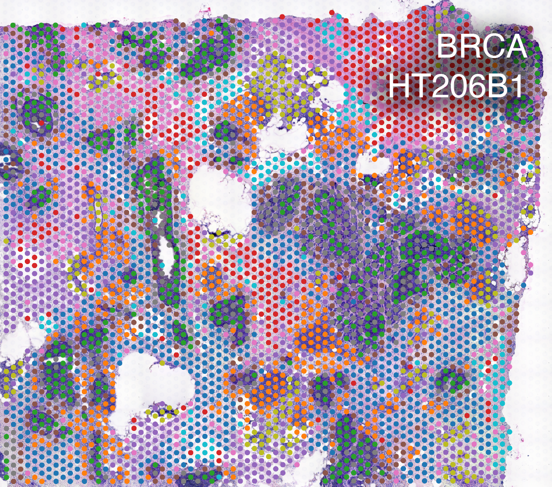 BRCA_HT206.png